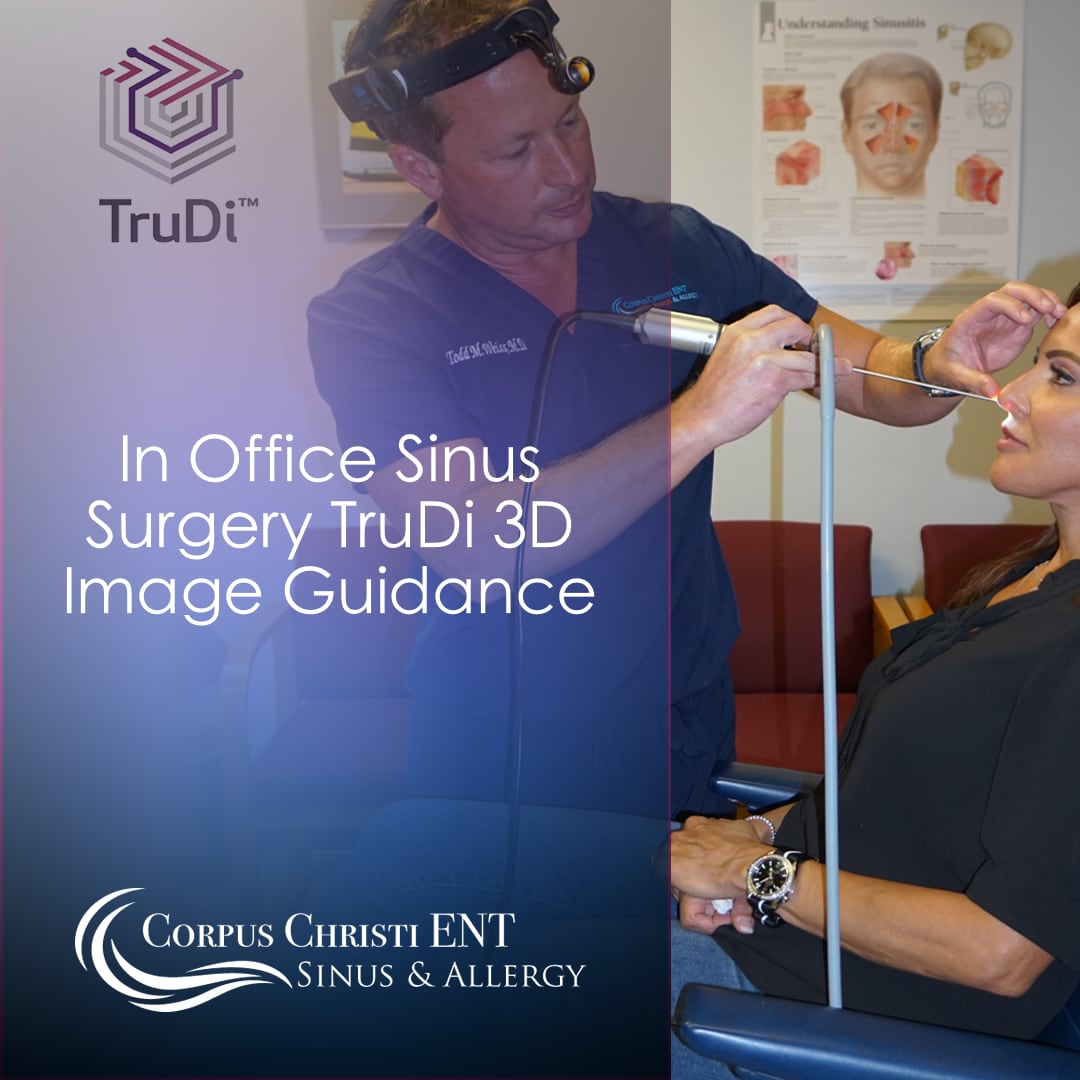 In Office Sinus Surgery Trudi™ 3d Image Guidance Corpus Christi Ent Sinus And Allergy