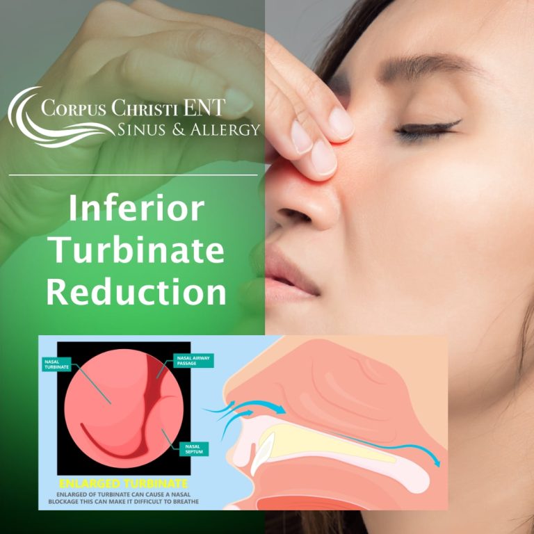 Inferior Turbinate Reduction – Corpus Christi ENT Sinus & Allergy