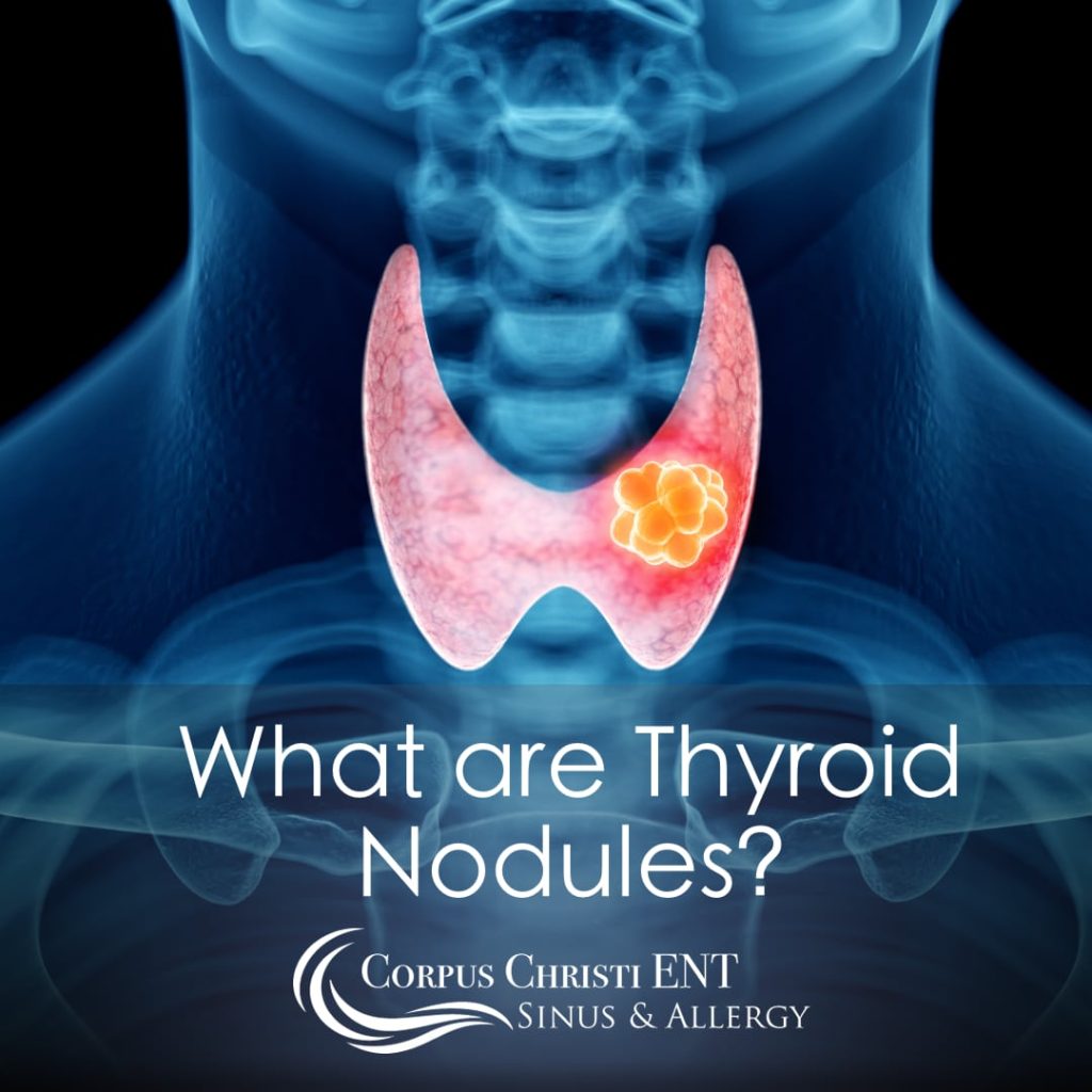 What are Thyroid Nodules? – Corpus Christi ENT Sinus & Allergy